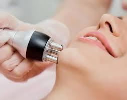 Процедура: RF-лифтинг лицо, шея, декольте (20 мин.) дополнительно