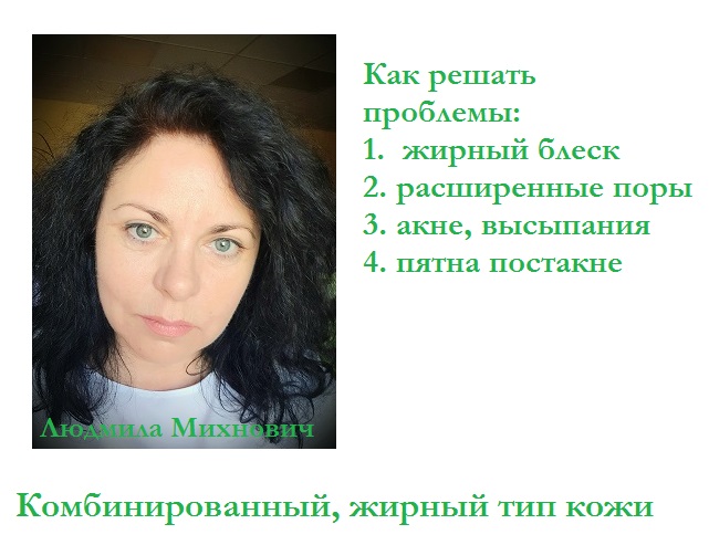 Комбинированный тип кожи: жирный блеск, расширенные поры, черные точки, акне, постакне, рубцы.