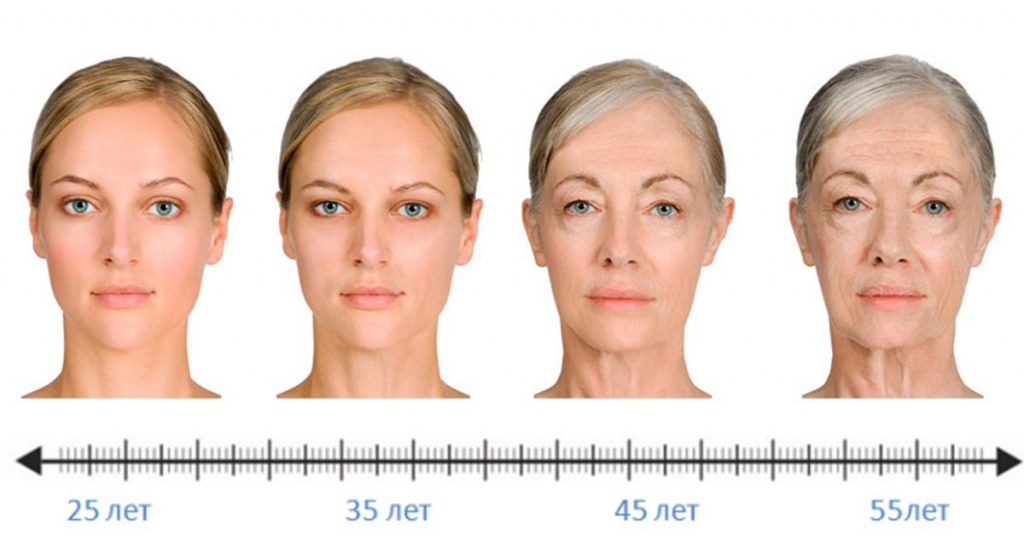 признаки старения 3 степень от 45-55 лет