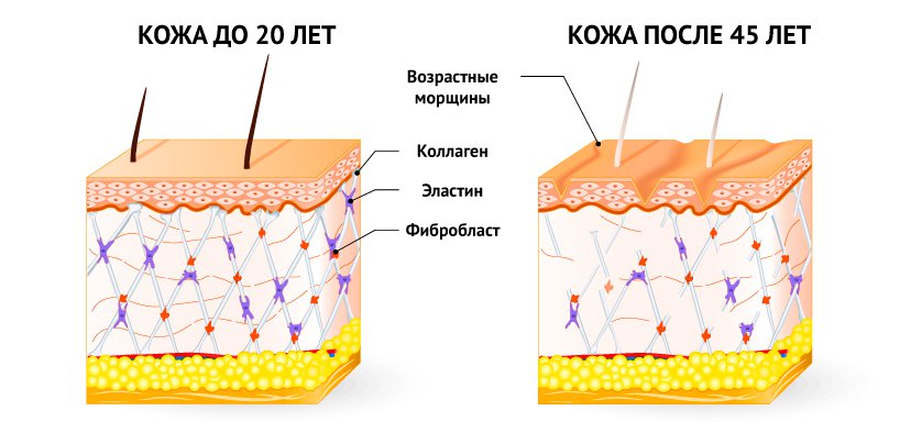 кожа в 20 лет и 45.jpg