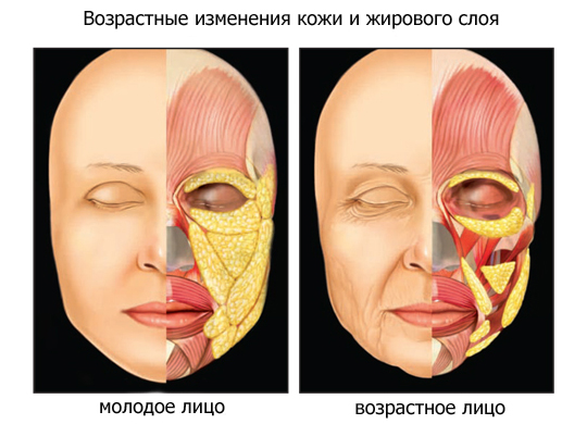 типы старения Признаки старения