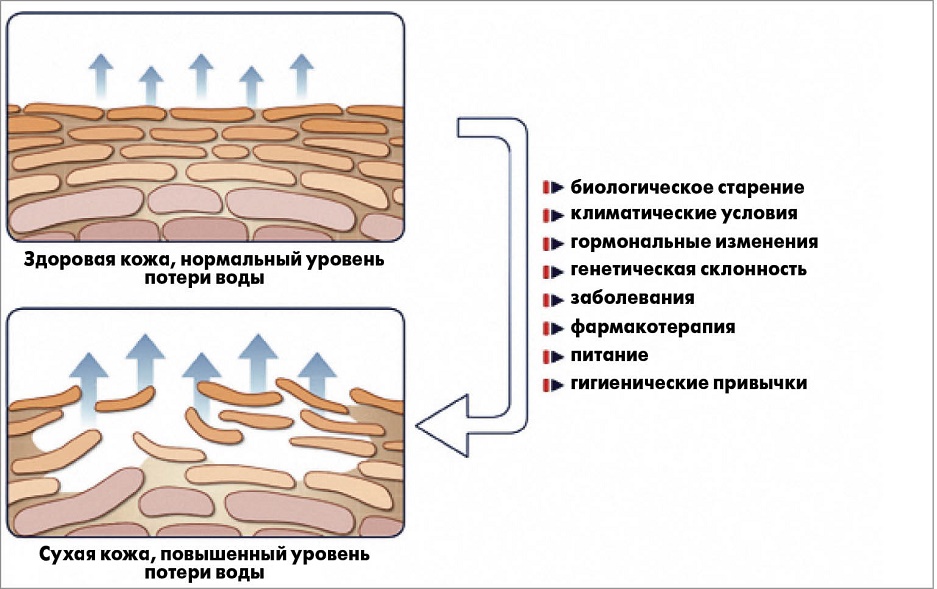 причины сухости кожи