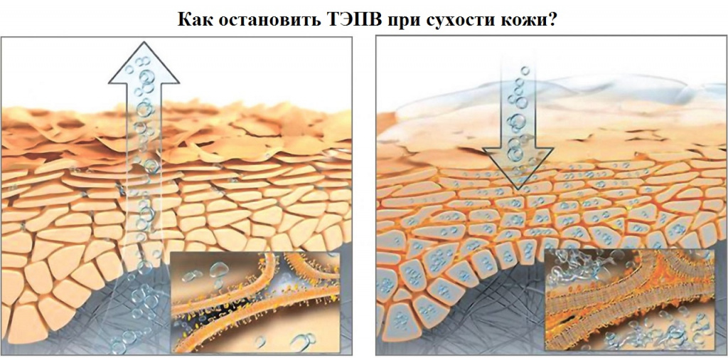 Как увлажнить кожу и восстановить ТЭПВ до нормы Как увлажнить кожу и восстановить ТЭПВ до нормы