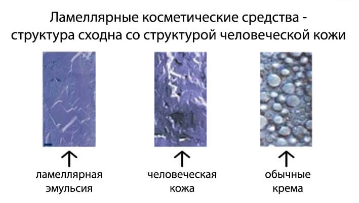 Ламеллярные крема Ламеллярные крема MLE