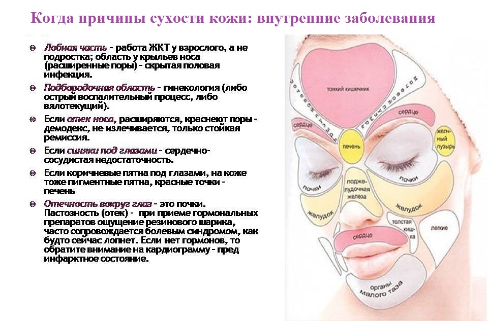 сухость кожи - проблемы человека внутри сухость кожи - проблемы человека внутри