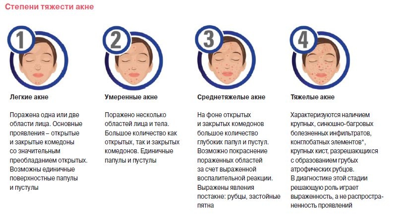 степени тяжести акне