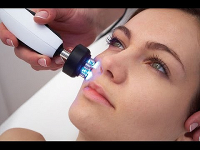 Процедура 1 зона: RF-лифтинг лицо (40 мин.)